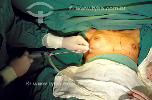  Hospital - Cirurgia para aplicação de silicone nos seios

 