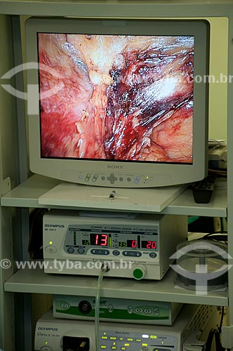 Assunto:  Hospital Federal de Ipanema - centro cirúrgico - cirurgia urológica - Tela de cirurgia videolaparoscópica.  / Local: Hospital Federal de Ipanema - Rio de Janeiro - RJ / Data: 10/2010 