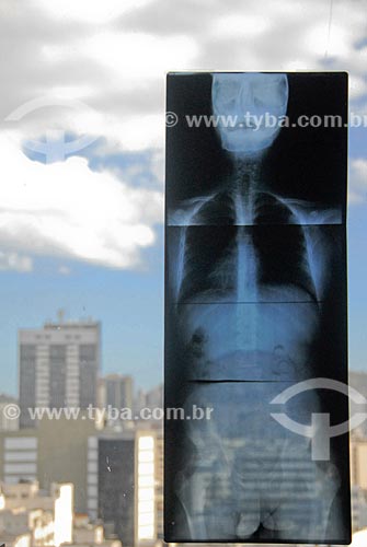  Assunto: Radiografia anexada em vidro de clinica de fisioterapia / Local: Rio de Janeiro (RJ) - Brasil / Data: 09/2007 