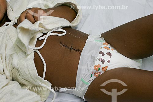  Criança vítima de bala perdida no Hospital Estadual Getúlio Vargas  - Rio de Janeiro - Rio de Janeiro - Brasil