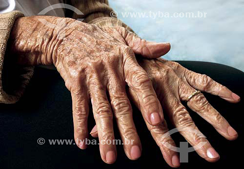  Detail of aged hands - Visual pattern 