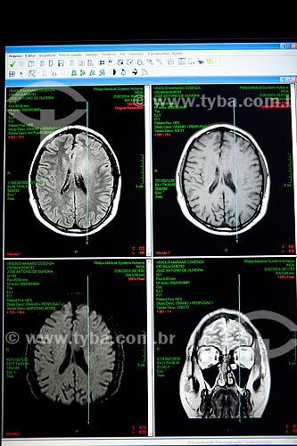  Subject: MRI - Magnectic Resonance Imaging in the INCA - National Cancer Institute of Brazil  / Place:  Cruz Vermelha Square - Rio de Janeiro city - Rio de Janeiro state - Brazil  / Date: 09-2010 