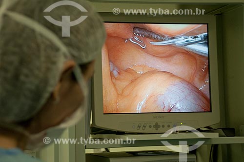  Federal Hospital de Ipanema, surgical center, urology surgery, doctor in radical prostatectomy procedure by video watch the screen rec of videolaparoscopic surgery  - Rio de Janeiro city - Brazil