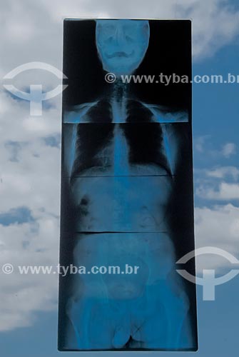  Subject: Radiography attached on glass of clinical of physiotherapy / Place: Rio de Janeiro state (RJ) - Brazil / Date: 09/2007 
