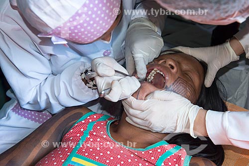  Dentist of the Special Department for Indigenous Health (SESAI) attending Caiapo indian - Moikarako tribe - Kayapo Indigenous Land  - Sao Felix do Xingu city - Para state (PA) - Brazil